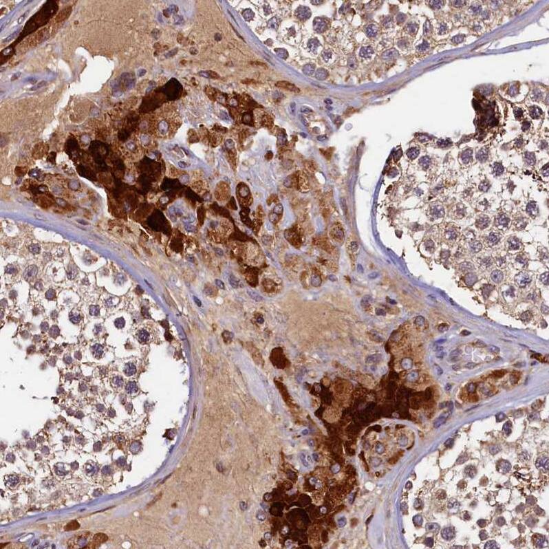 NCKAP5L Antibody - BSA Free Immunohistochemistry: NCKAP5L Antibody - BSA Free [NBP1-93583]