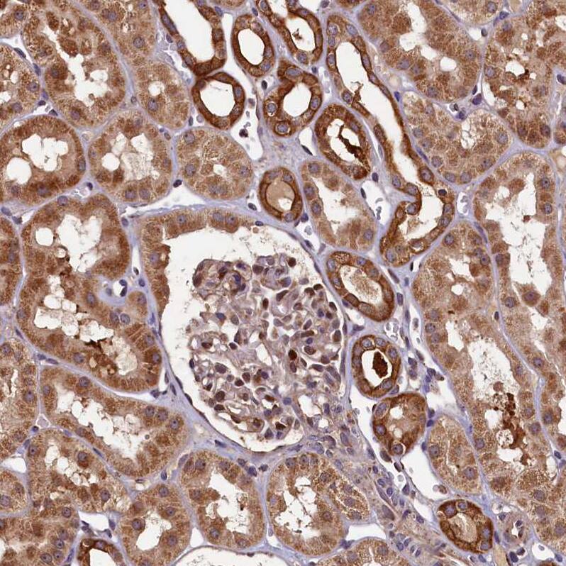 NCKAP5L Antibody - BSA Free Immunohistochemistry: NCKAP5L Antibody - BSA Free [NBP1-93583]