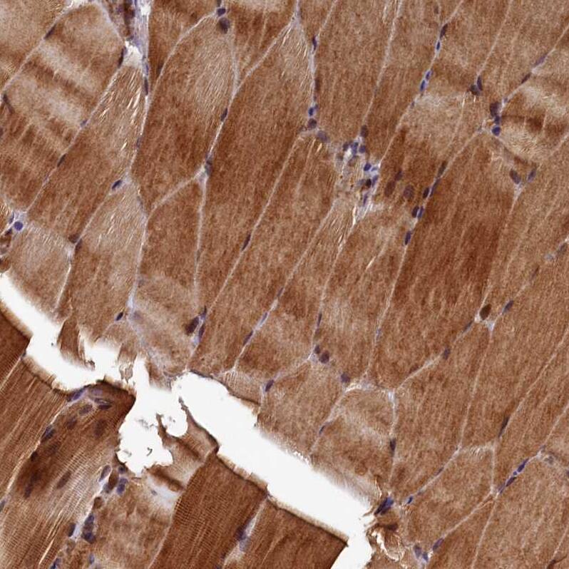 NCKAP5L Antibody - BSA Free Immunohistochemistry: NCKAP5L Antibody - BSA Free [NBP1-93583]