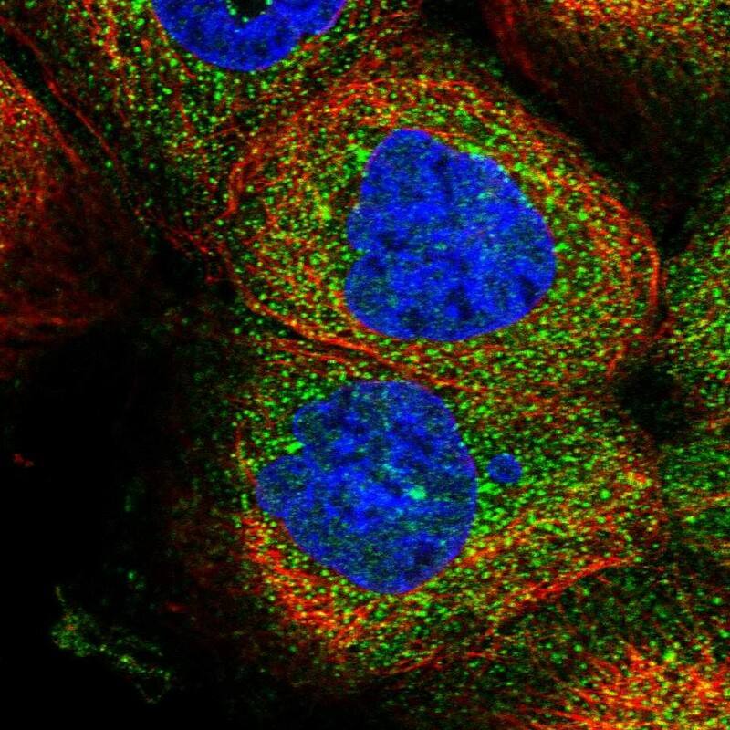 ZSWIM6 Antibody - BSA Free Immunocytochemistry/ Immunofluorescence: ZSWIM6 Antibody - BSA Free [NBP1-93584]