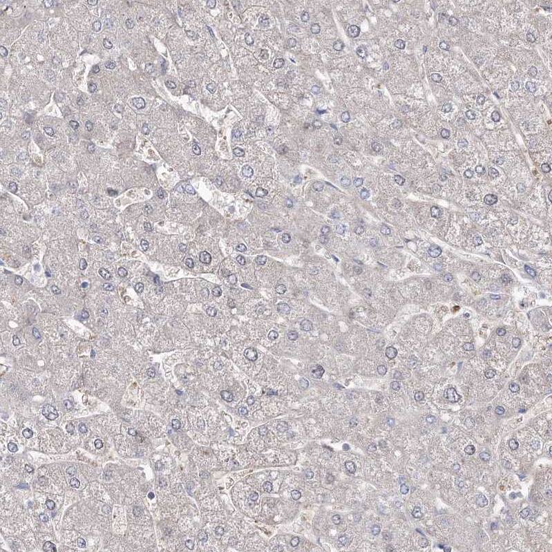 ZSWIM6 Antibody - BSA Free Immunohistochemistry: ZSWIM6 Antibody - BSA Free [NBP1-93584]