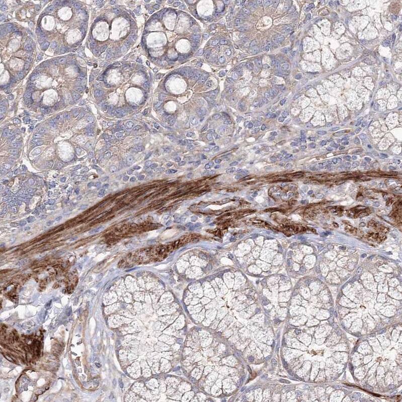 ZSWIM6 Antibody - BSA Free Immunohistochemistry: ZSWIM6 Antibody - BSA Free [NBP1-93584]