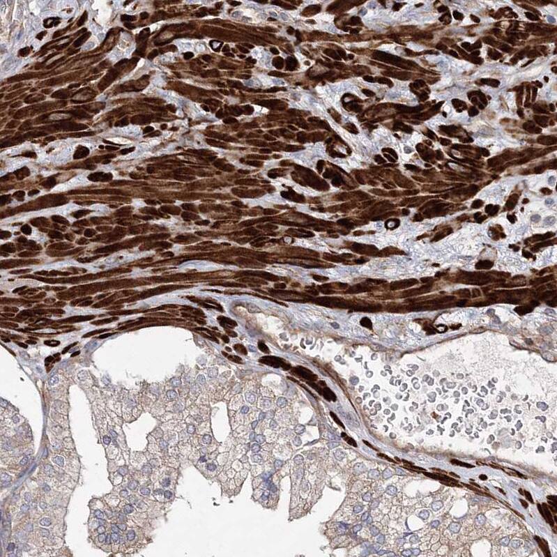 ZSWIM6 Antibody - BSA Free Immunohistochemistry: ZSWIM6 Antibody - BSA Free [NBP1-93584]