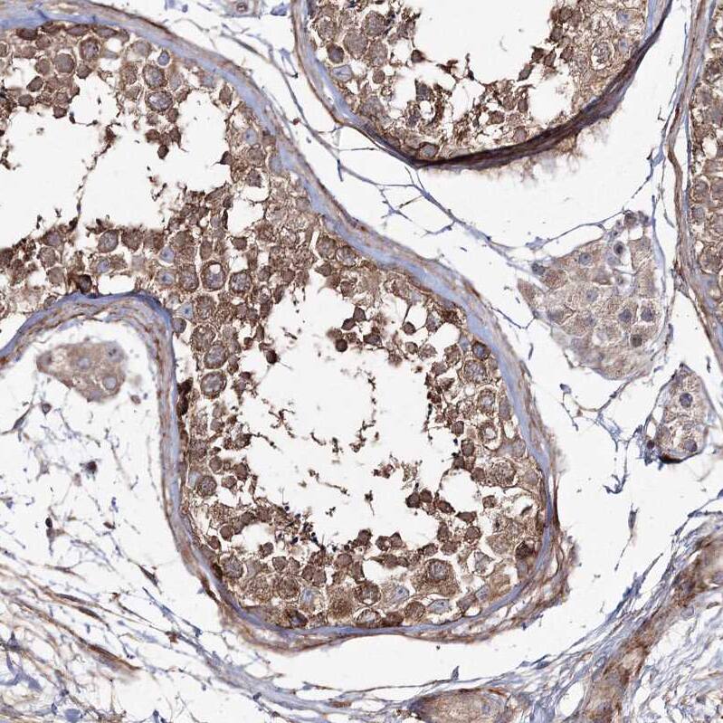 ZSWIM6 Antibody - BSA Free Immunohistochemistry: ZSWIM6 Antibody - BSA Free [NBP1-93584]