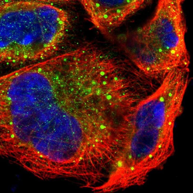 P-Rex1 Antibody - BSA Free Immunocytochemistry/ Immunofluorescence: P-Rex1 Antibody [NBP1-93590]