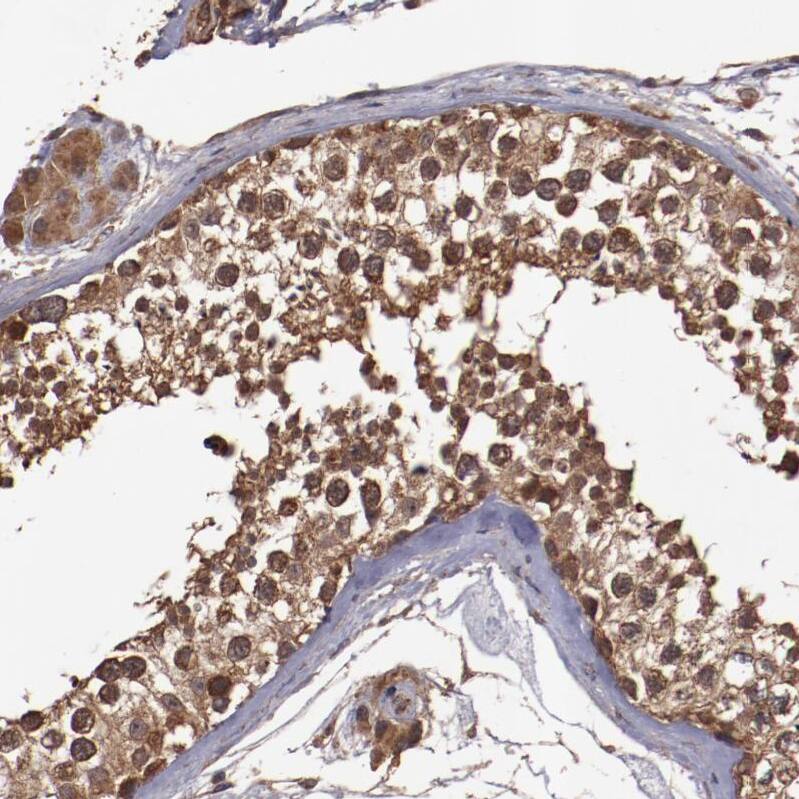 TXNDC16 Antibody - BSA Free Immunohistochemistry: TXNDC16 Antibody - BSA Free [NBP1-93591]