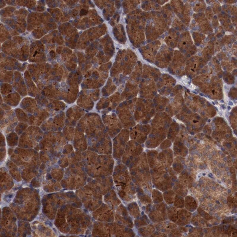 TXNDC16 Antibody - BSA Free Immunohistochemistry: TXNDC16 Antibody - BSA Free [NBP1-93591]