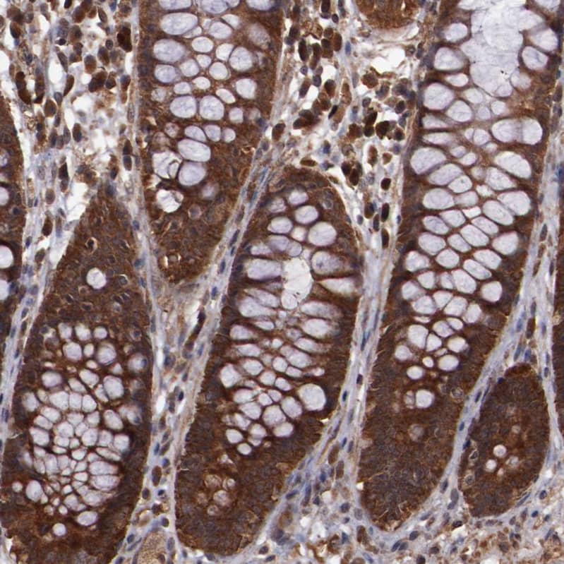 TXNDC16 Antibody - BSA Free Immunohistochemistry: TXNDC16 Antibody - BSA Free [NBP1-93591]
