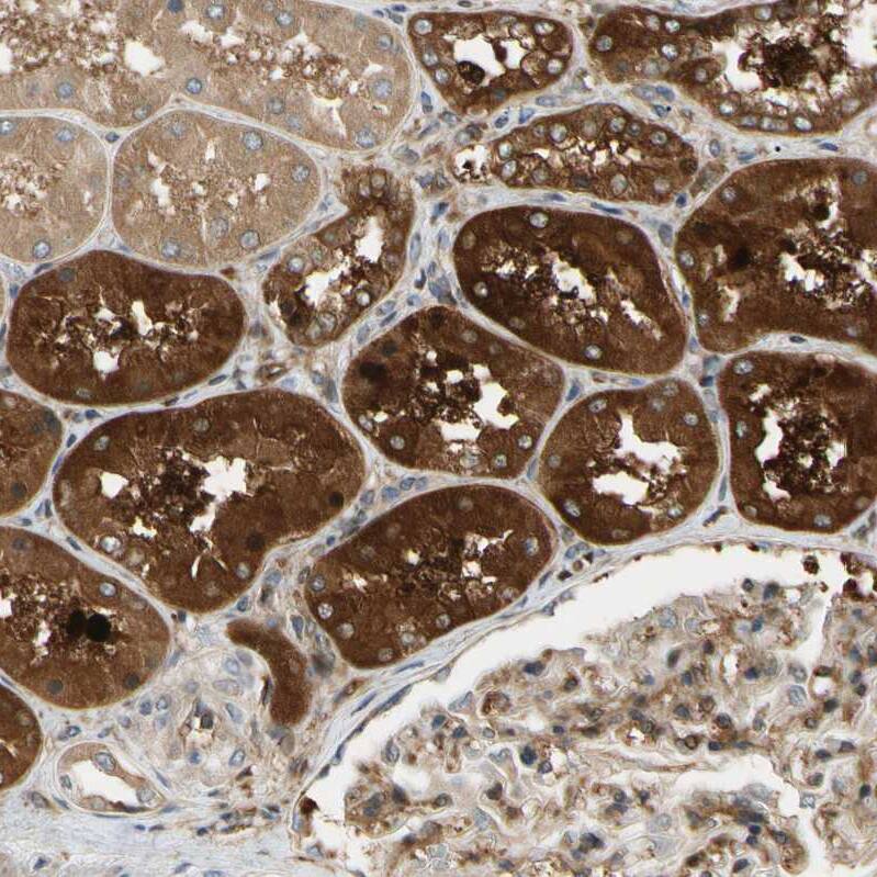 PARP14 Antibody - BSA Free Immunohistochemistry: PARP14 Antibody - BSA Free [NBP1-93592]