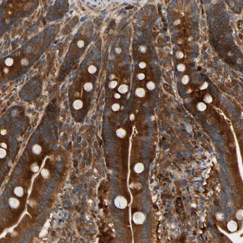 PARP14 Antibody - BSA Free Immunohistochemistry: PARP14 Antibody - BSA Free [NBP1-93592]