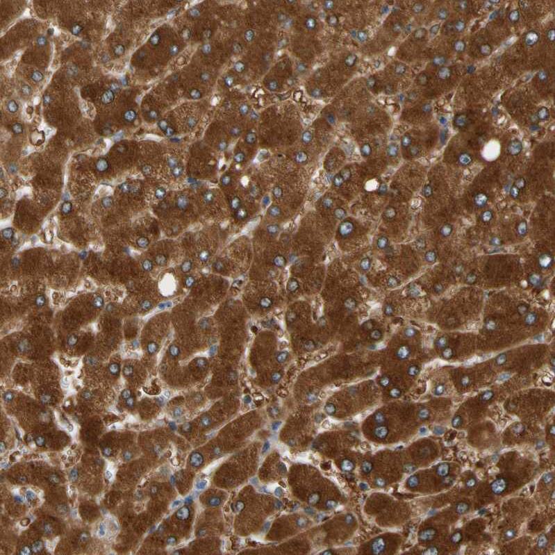 PARP14 Antibody - BSA Free Immunohistochemistry: PARP14 Antibody - BSA Free [NBP1-93592]