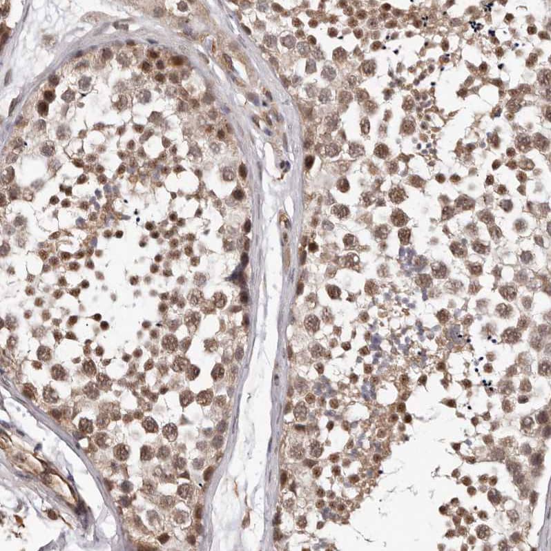 PRR12 Antibody - BSA Free Immunohistochemistry: PRR12 Antibody - BSA Free [NBP1-93595]