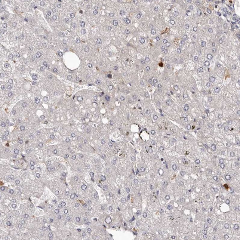 PRR12 Antibody - BSA Free Immunohistochemistry: PRR12 Antibody - BSA Free [NBP1-93595]