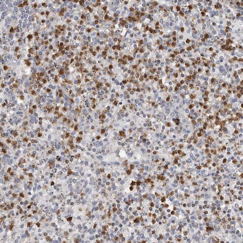 PRR12 Antibody - BSA Free Immunohistochemistry: PRR12 Antibody - BSA Free [NBP1-93595]