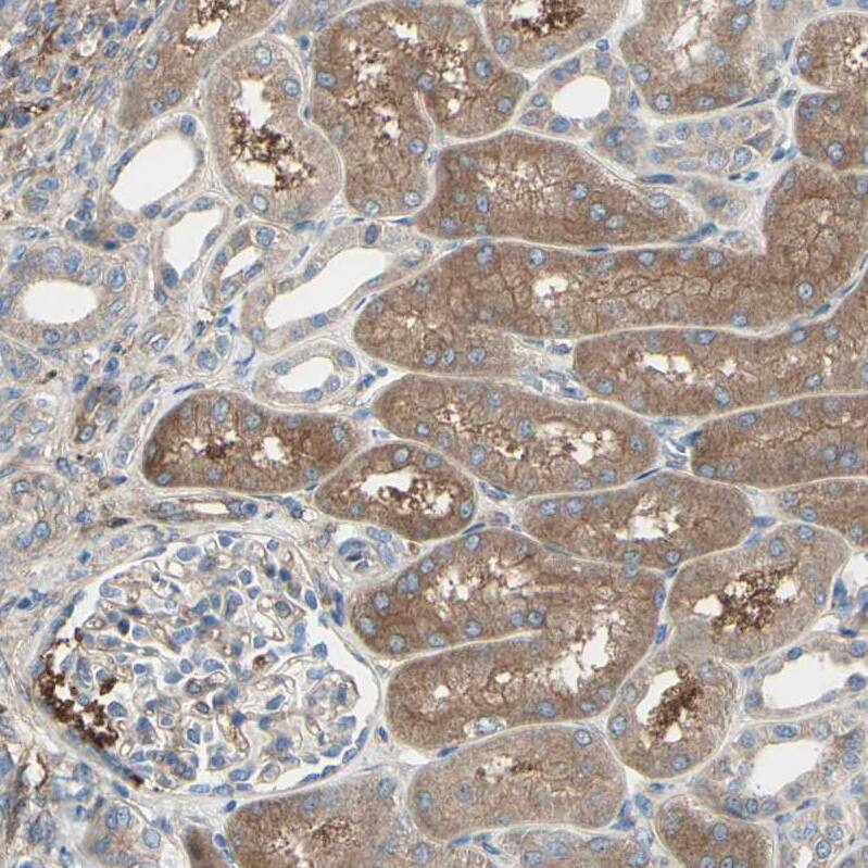 IGSF9B Antibody - BSA Free Immunohistochemistry: IGSF9B Antibody - BSA Free [NBP1-93608]
