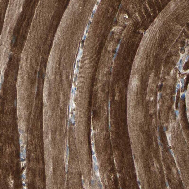 IGSF9B Antibody - BSA Free Immunohistochemistry: IGSF9B Antibody - BSA Free [NBP1-93608]