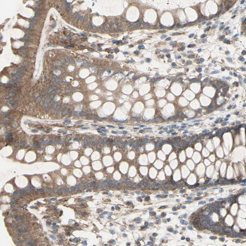 IGSF9B Antibody - BSA Free Immunohistochemistry: IGSF9B Antibody - BSA Free [NBP1-93608]