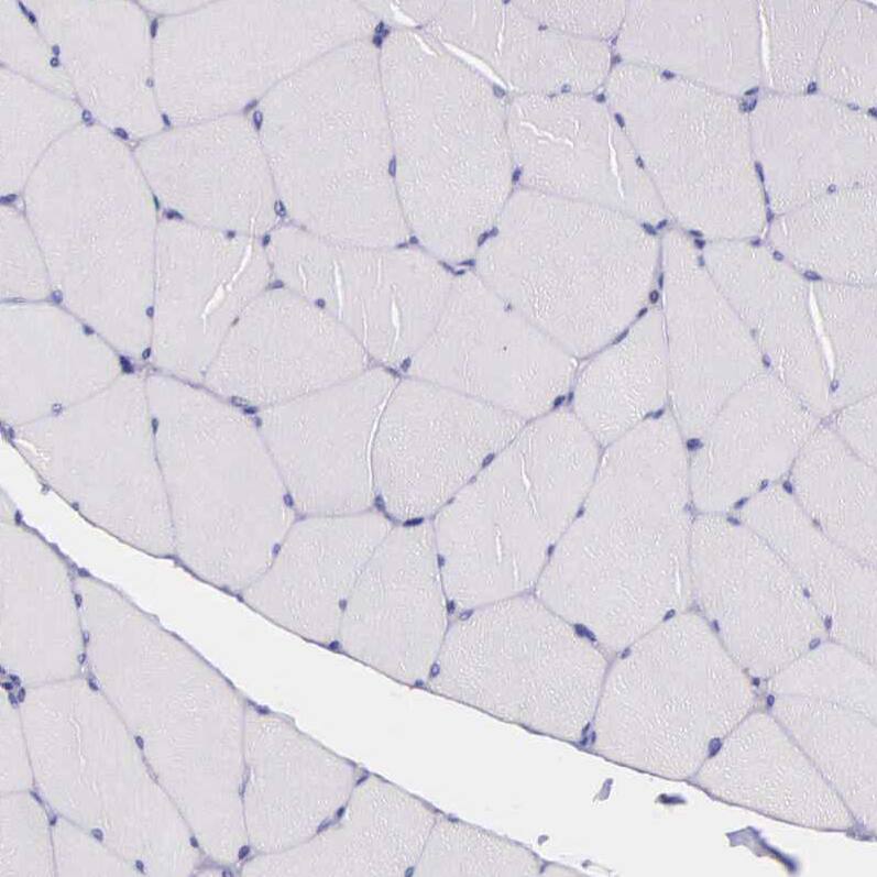 THSD7A Antibody - BSA Free Immunohistochemistry: THSD7A Antibody - BSA Free [NBP1-93612]