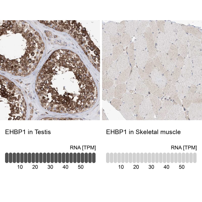 EHBP1 Antibody - BSA Free Immunohistochemistry: EHBP1 Antibody - BSA Free [NBP1-93614]