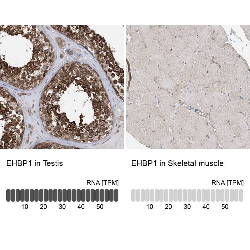 EHBP1 Antibody - BSA Free Immunohistochemistry: EHBP1 Antibody - BSA Free [NBP1-93615]