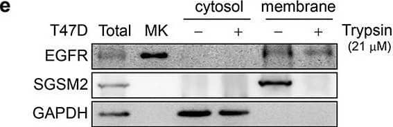 SGSM2 Antibody - BSA Free