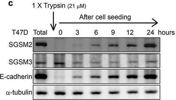 SGSM2 Antibody - BSA Free