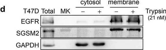 SGSM2 Antibody - BSA Free