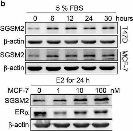 SGSM2 Antibody - BSA Free