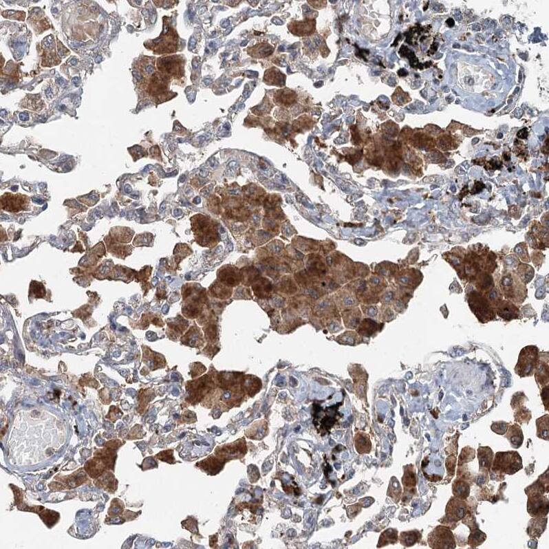 TTC37 Antibody - BSA Free Immunohistochemistry: TTC37 Antibody - BSA Free [NBP1-93640]