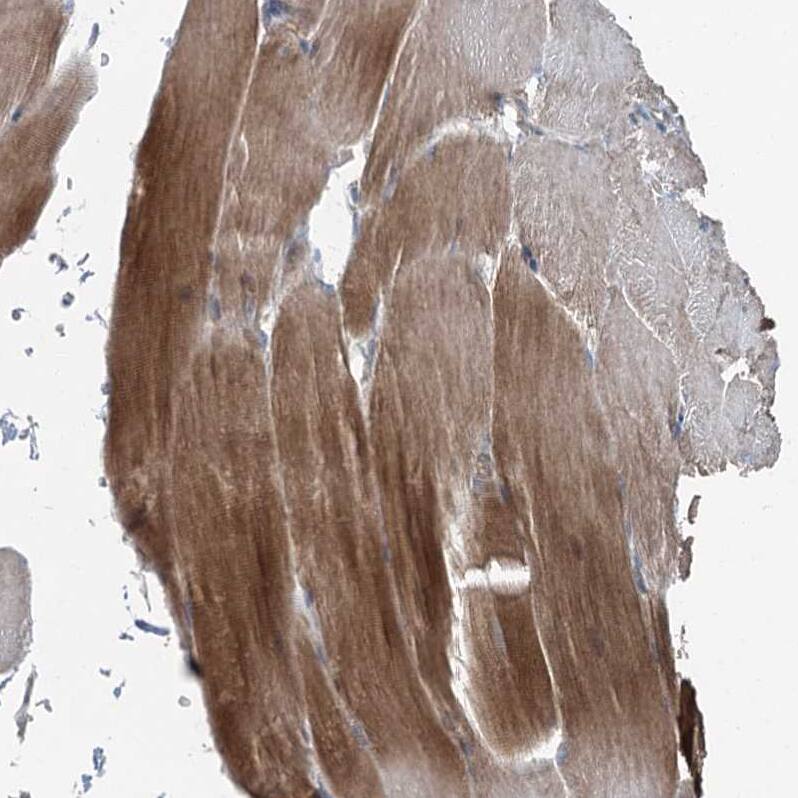 TTC37 Antibody - BSA Free Immunohistochemistry: TTC37 Antibody - BSA Free [NBP1-93640]