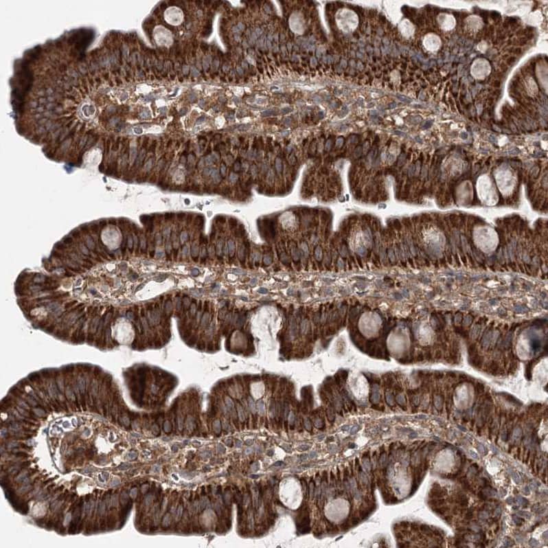 TTC37 Antibody - BSA Free Immunohistochemistry: TTC37 Antibody - BSA Free [NBP1-93640]