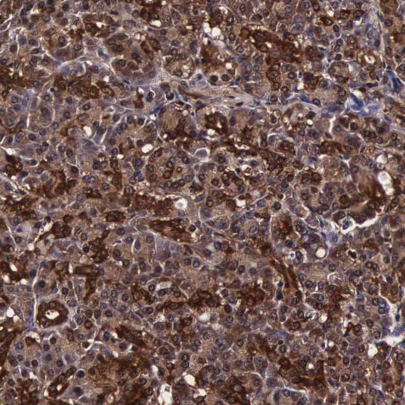 TECPR2 Antibody - BSA Free Immunohistochemistry: TECPR2 Antibody - BSA Free [NBP1-93642]
