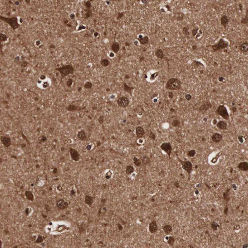 TECPR2 Antibody - BSA Free Immunohistochemistry: TECPR2 Antibody - BSA Free [NBP1-93642]