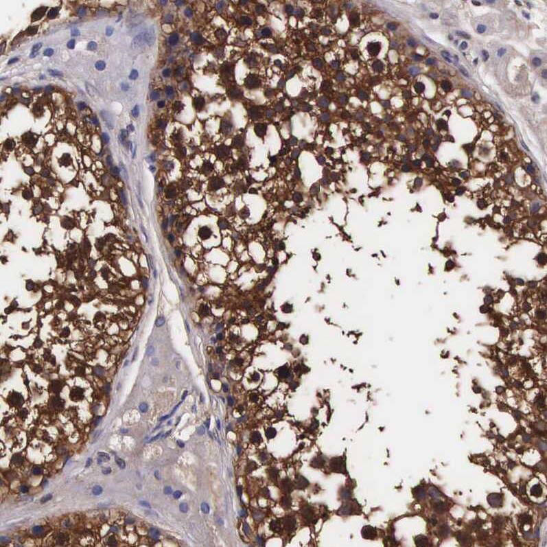 TECPR2 Antibody - BSA Free Immunohistochemistry: TECPR2 Antibody - BSA Free [NBP1-93642]