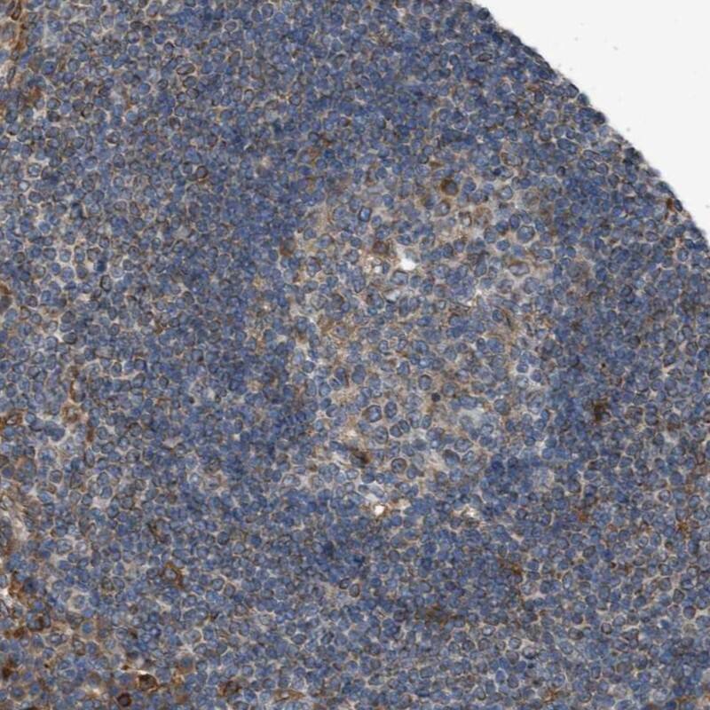 TMEM194A Antibody - BSA Free Immunohistochemistry: TMEM194A Antibody - BSA Free [NBP1-93649]