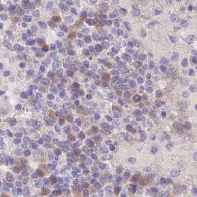 FAM168B Antibody - BSA Free Immunohistochemistry: FAM168B Antibody - BSA Free [NBP1-93650]