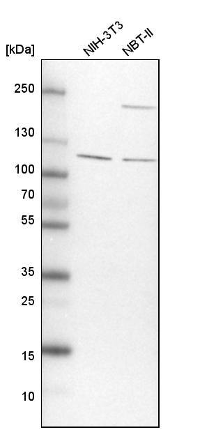 TBC1D5 Antibody - BSA Free Western Blot: TBC1D5 Antibody - BSA Free [NBP1-93653]