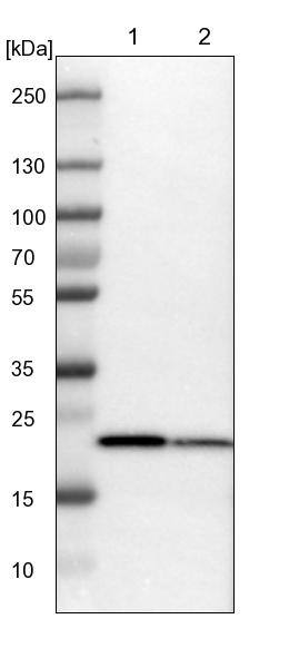SPCS2 Antibody - BSA Free Western Blot: SPCS2 Antibody - BSA Free [NBP1-93656]