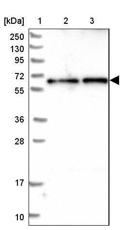 CCDC125 Antibody - BSA Free Western Blot: CCDC125 Antibody - BSA Free [NBP1-93660]