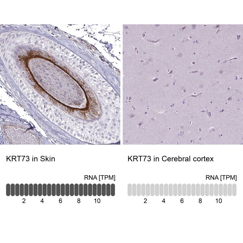 KRT73 Antibody Immunohistochemistry-Paraffin: KRT73 Antibody [NBP1-93670]