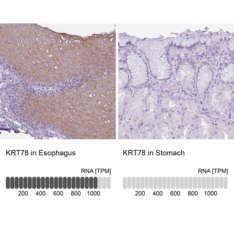 KRT78 Antibody - BSA Free Immunohistochemistry: KRT78 Antibody - BSA Free [NBP1-93671]