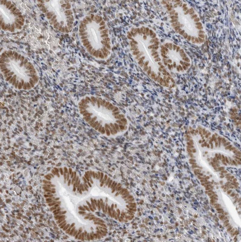IRF2BP2 Antibody - BSA Free Immunohistochemistry: IRF2BP2 Antibody - BSA Free [NBP1-93674]