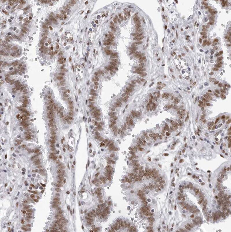 IRF2BP2 Antibody - BSA Free Immunohistochemistry: IRF2BP2 Antibody - BSA Free [NBP1-93674]