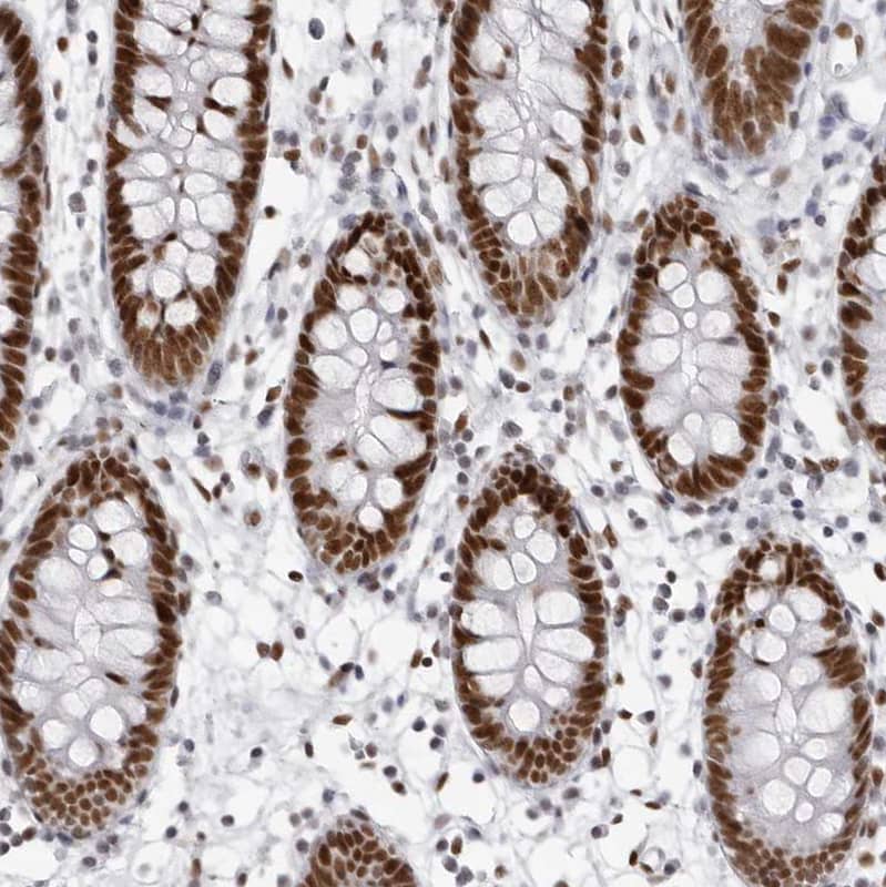 IRF2BP2 Antibody - BSA Free Immunohistochemistry: IRF2BP2 Antibody - BSA Free [NBP1-93674]