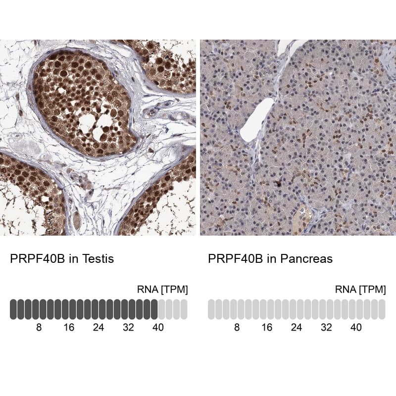 PRPF40B Antibody - BSA Free Immunohistochemistry: PRPF40B Antibody - BSA Free [NBP1-93680]