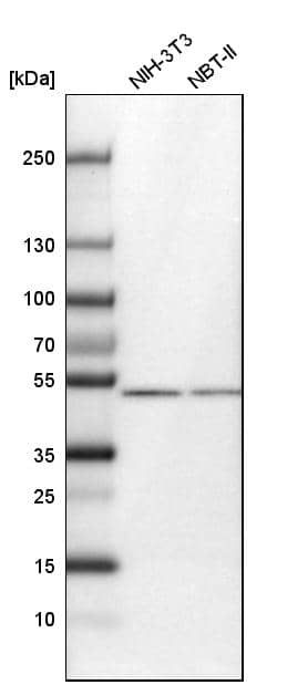 CDR2L Antibody - BSA Free Western Blot: CDR2L Antibody - BSA Free [NBP1-93681]