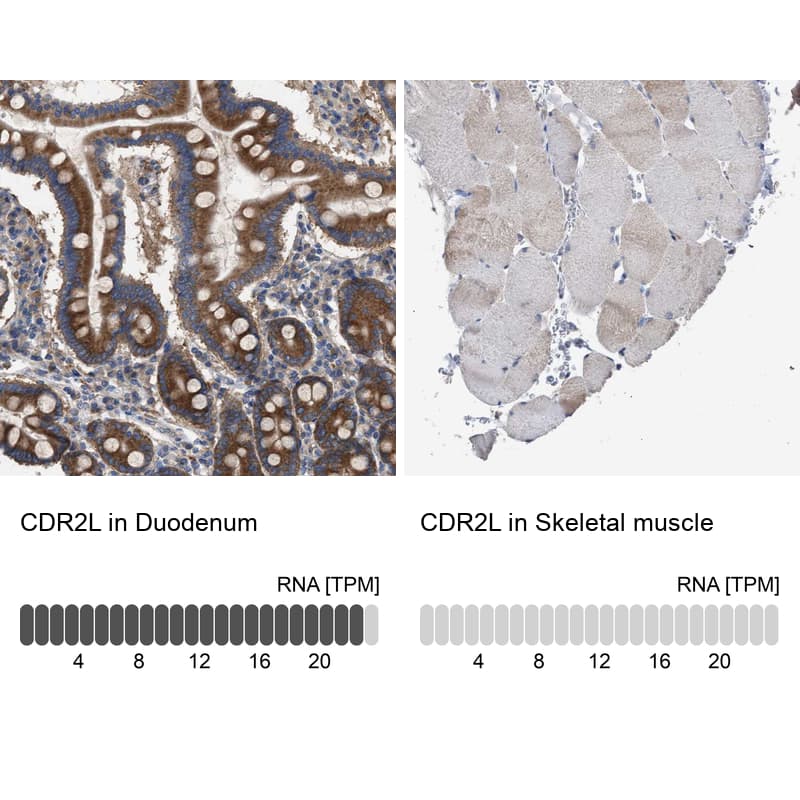 CDR2L Antibody - BSA Free Immunohistochemistry: CDR2L Antibody - BSA Free [NBP1-93681]