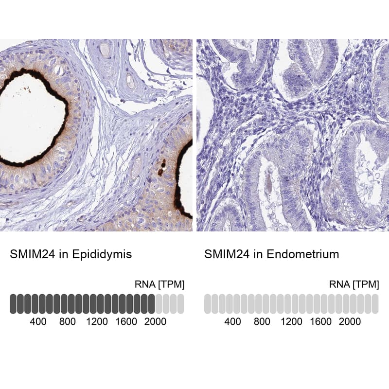 HSPC323 Antibody - BSA Free Immunohistochemistry: HSPC323 Antibody - BSA Free [NBP1-93687]