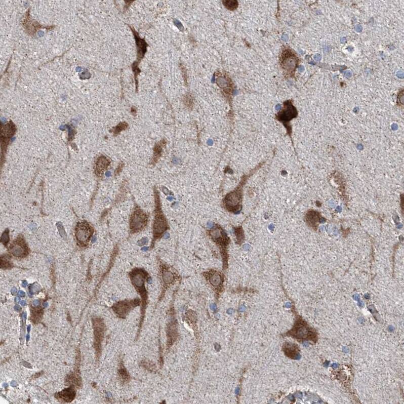 AGPAT9 Antibody - BSA Free Immunohistochemistry: AGPAT9 Antibody - BSA Free [NBP1-93692]