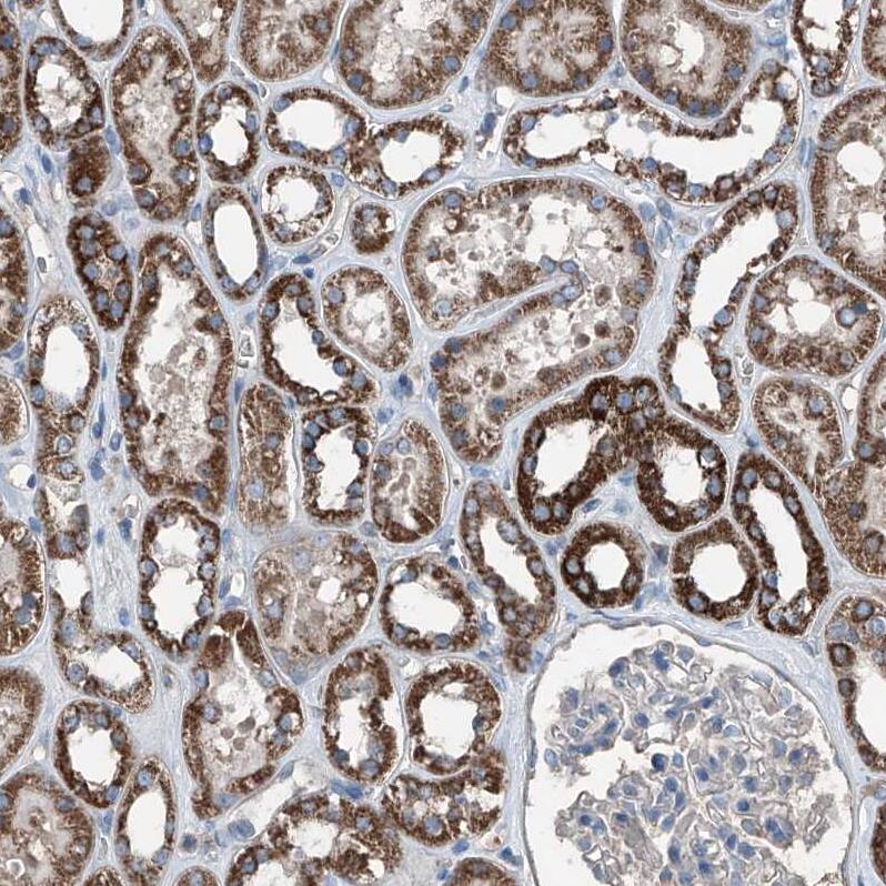AGPAT9 Antibody - BSA Free Immunohistochemistry: AGPAT9 Antibody - BSA Free [NBP1-93692]